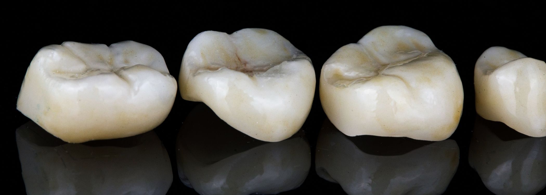 Pembuatan Crown dan Bridge