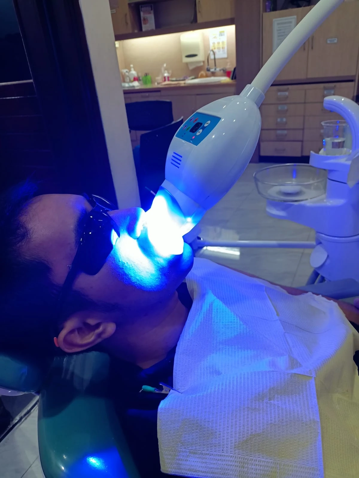 Klinik Gigi Cempaka Putih untuk Scaling & Bleaching