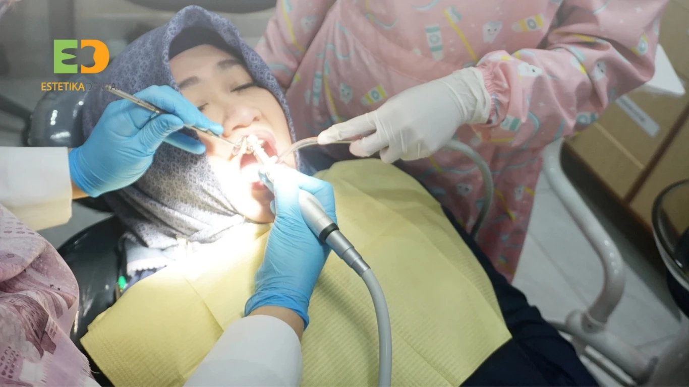 Scaling Gigi Cempaka Putih: Kapan Karang Gigi Harus Dibersihkan?