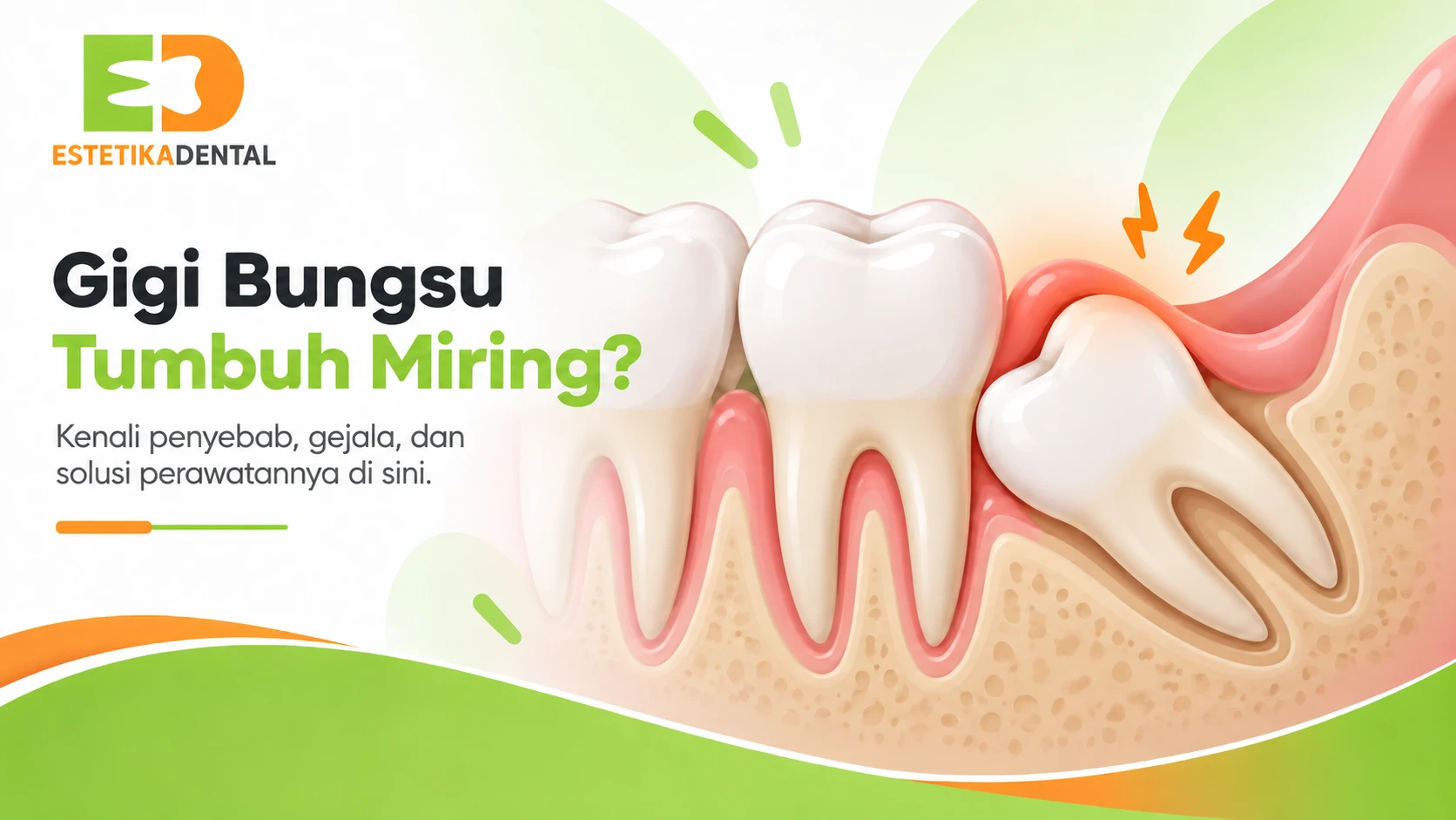 Gigi Bungsu Tumbuh Miring? 5 Tanda Perlu Dicabut